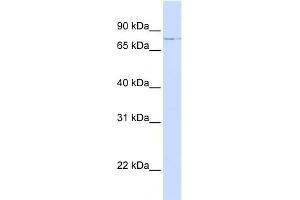 WB Suggested Anti-LCP1 Antibody Titration: 0.