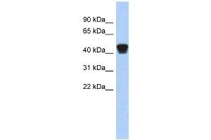 TXNDC4 antibody used at 1 ug/ml to detect target protein. (ERP44 antibody)