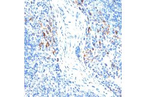 Immunohistochemistry of paraffin-embedded mouse spleen using MMP9 antibody (ABIN6131951, ABIN6143920, ABIN6143923 and ABIN6213777) at dilution of 1:100 (40x lens). (MMP 9 antibody  (AA 538-707))