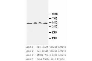 Image no. 1 for anti-Cathepsin D (CTSD) antibody (ABIN1502057) (Cathepsin D antibody)