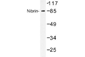 Image no. 1 for anti-Nibrin (NBN) antibody (ABIN272298) (Nibrin antibody)
