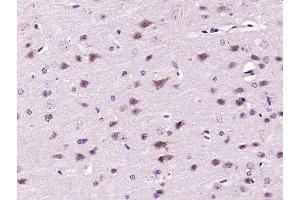 Paraformaldehyde-fixed, paraffin embedded mouse brain, Antigen retrieval by boiling in sodium citrate buffer (pH6) for 15min, Block endogenous peroxidase by 3% hydrogen peroxide for 30 minutes,  Blocking buffer (normal goat serum) at 37°C for 20min, Antibody incubation with p90RSK (Ser380) Polyclonal Antibody at 1:400 overnight at 4°C, followed by a conjugated secondary and DAB staining. (RPS6KA3 antibody  (pSer380))