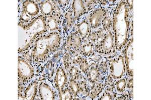 IHC analysis of MRE11 using anti-MRE11 antibody (ABIN7601056). (Mre11 antibody  (AA 278-498))