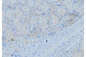 ABIN6279339 at 1/100 staining Mouse kidney tissue by IHC-P. (DYNC1I2 antibody  (N-Term))