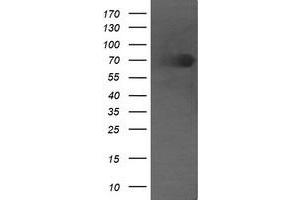 Image no. 1 for anti-Differentially Expressed in FDCP 6 Homolog (DEF6) antibody (ABIN1497811) (DEF6 antibody)