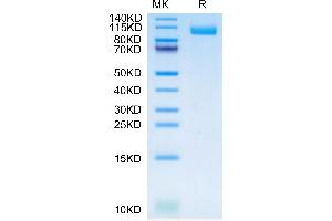 Cynomolgus TLR3 on Tris-Bis PAGE under reduced condition. (TLR3 Protein (AA 31-711) (His tag))