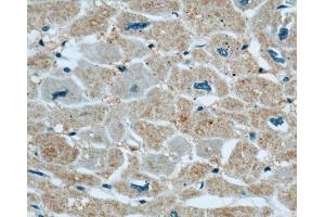 Immunohistochemistry (IHC) image for anti-Xin Actin-Binding Repeat Containing 2 (XIRP2) antibody (ABIN2906145) (XIRP2 antibody)