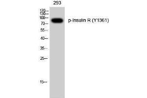 Western Blotting (WB) image for anti-Insulin Receptor (INSR) (pTyr1361) antibody (ABIN3173234) (Insulin Receptor antibody  (pTyr1361))