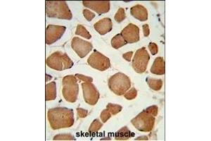 Formalin-fixed and paraffin-embedded human skeletal muscle reacted with ANGPTL4 Antibody (Center), which was peroxidase-conjugated to the secondary antibody, followed by DAB staining. (ANGPTL4 antibody  (AA 138-167))