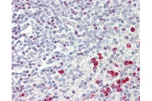 Immunohistochemistry (IHC) image for anti-Guanine Nucleotide Binding Protein (G Protein), Q Polypeptide (GNAQ) (Center) antibody (ABIN2855848)