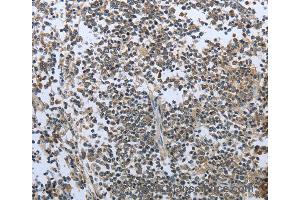 Immunohistochemistry of Human tonsil using PRL Polyclonal Antibody at dilution of 1:30