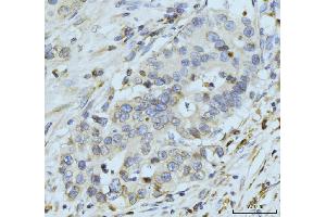 IHC analysis of GP210/NUP210 using anti-GP210/NUP210 antibody (ABIN7600707).