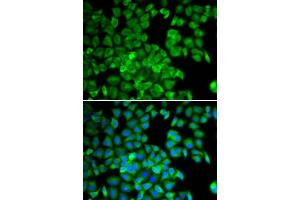 Immunofluorescence analysis of U2OS cells using TCP1 antibody. (TCP1 alpha/CCTA antibody  (AA 307-556))