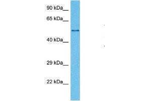 Host:  Mouse  Target Name:  MAOB  Sample Tissue:  Mouse Testis  Antibody Dilution:  1ug/ml (Monoamine Oxidase B antibody  (N-Term))