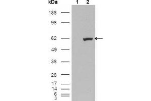 Western blot analysis using ETV1 mouse mAb against HEK293T cells transfected with the pCMV6-ENTRY control (1) and pCMV6-ENTRY ETV1 cDNA (2). (ETV1 antibody)