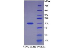 SDS-PAGE (SDS) image for Microseminoprotein, beta (MSMB) (AA 19-114) protein (His tag) (ABIN1099298) (MSMB Protein (AA 19-114) (His tag))
