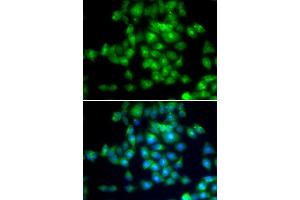 Immunofluorescence analysis of MCF-7 cells using SIRT3 antibody. (SIRT3 antibody  (C-Term))