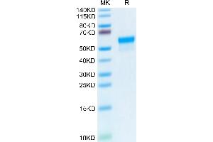 Mouse LGMN on Tris-Bis PAGE under reduced condition. (LGMN Protein (AA 18-435) (His tag))