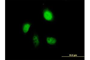 Immunofluorescence of purified MaxPab antibody to ANXA7 on HeLa cell.