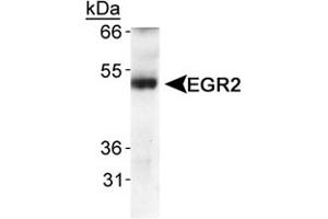 Western blot analysis of EGR2 in human fetal lung tissue using EGR2 polyclonal antibody . (EGR2 antibody  (AA 200-300))