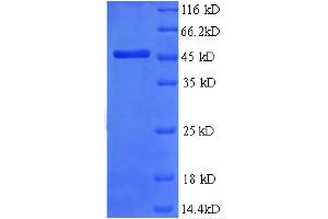 SDS-PAGE (SDS) image for Metalloproteinase Inhibitor 2 (TIMP2) (AA 30-220), (partial) protein (GST tag) (ABIN5712524) (TIMP2 Protein (AA 30-220, partial) (GST tag))
