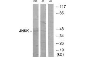 Western blot analysis of extracts from 293/Jurkat cells, using JNKK Antibody. (MAP2K4 antibody  (AA 316-365))
