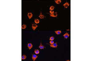 Immunofluorescence analysis of L929 cells using MFI2 Rabbit pAb (ABIN6131379, ABIN6143795, ABIN6143796 and ABIN6222350) at dilution of 1:100 (40x lens). (MFI2 antibody  (AA 20-200))