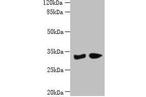 Western blot All lanes: PBLD antibody at 6 μg/mL Lane 1: Mouse liver tissue Lane 2: Mouse kidney tissue Secondary Goat polyclonal to rabbit IgG at 1/10000 dilution Predicted band size: 32 kDa Observed band size: 32 kDa (PBLD1 antibody  (AA 11-288))