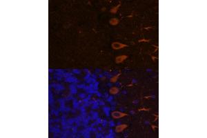 Immunofluorescence (IF) image for anti-Kallmann Syndrome 1 Sequence (KAL1) (AA 200-300) antibody (ABIN7268068)