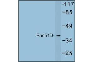 Image no. 1 for anti-RAD51 Homolog D (RAD51D) antibody (ABIN317685) (RAD51D antibody)