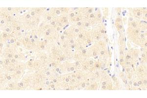 Detection of UBAP2 in Human Liver Tissue using Polyclonal Antibody to Ubiquitin Associated Protein 2 (UBAP2) (UBAP2 antibody  (AA 1-104))