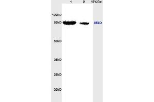 Lane 1: rat heart lysates Lane 2: rat brain lysates probed with Anti phospho-STAT3(Ser727) Polyclonal Antibody, Unconjugated (ABIN746198) at 1:200 in 4 °C. (STAT3 antibody  (pSer727))