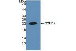 Detection of Recombinant CYFRA21-1, Human using Polyclonal Antibody to Cytokeratin Fragment Antigen 21-1 (CYFRA21-1) (CYFRA21.1 antibody  (AA 244-400))