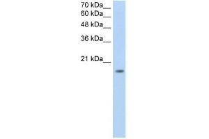 ZNF580 antibody used at 0. (ZNF580 antibody  (N-Term))
