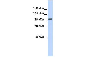 Western Blotting (WB) image for anti-Zinc Finger Protein 512B (ZNF512B) antibody (ABIN2458007) (ZNF512B antibody)