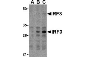 Western Blotting (WB) image for anti-Interferon Regulatory Factor 3 (IRF3) (Middle Region) antibody (ABIN1030963) (IRF3 antibody  (Middle Region))