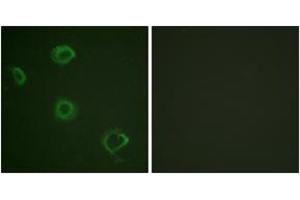 Immunofluorescence analysis of A549 cells, using Interferon-gamma Receptor alpha (Phospho-Tyr457) Antibody. (IFNGR1 antibody  (pTyr457))