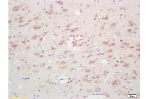 Formalin-fixed and paraffin embedded rat brain labeled with Rabbit Anti Ninein/GSK3B interacting protein Polyclonal Antibody, Unconjugated (ABIN872552) at 1:200 followed by conjugation to the secondary antibody and DAB staining