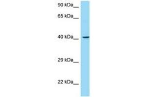 Image no. 1 for anti-Mucosal Vascular Addressin Cell Adhesion Molecule 1 (MADCAM1) (AA 235-284) antibody (ABIN6748404) (MADCAM1 antibody  (AA 235-284))