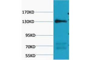 Western Blotting (WB) image for anti-Nitric Oxide Synthase 3 (Endothelial Cell) (NOS3) antibody (ABIN3178717) (ENOS antibody)