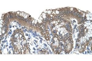 Human Stomach (RARRES3 antibody  (Middle Region))