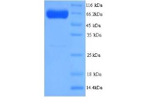 SDS-PAGE (SDS) image for Pyruvate Kinase, Liver and RBC (PKLR) (AA 1-574), (full length) protein (His tag) (ABIN5713732) (PKLR Protein (AA 1-574, full length) (His tag))