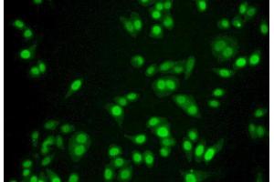 Figure:FITC staining on IHC-P Simple: Hela cells (IFI35 antibody  (AA 2-286))