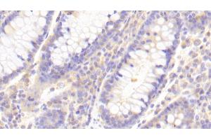 Detection of TLR8 in Human Colon Tissue using Polyclonal Antibody to Toll Like Receptor 8 (TLR8) (TLR8 antibody  (AA 844-1039))