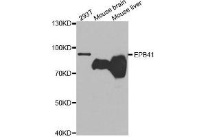 Western Blotting (WB) image for anti-Erythrocyte Membrane Protein Band 4.1 (Elliptocytosis 1, RH-Linked) (EPB41) antibody (ABIN1872554)