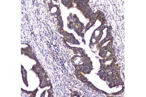IHC analysis of CLPX using anti-CLPX antibody . (CLPX antibody  (AA 337-574))