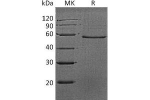 Western Blotting (WB) image for Dermatopontin (DPT) protein (Fc Tag) (ABIN7320839) (Dermatopontin Protein (DPT) (Fc Tag))