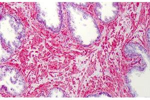 Human Prostate: Formalin-Fixed, Paraffin-Embedded (FFPE) (SLC5A3 antibody  (AA 221-270))