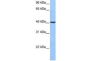 WB Suggested Anti-AGBL5 Antibody Titration: 0.