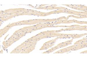 Immunohistochemistry (IHC) image for anti-Tumor Necrosis Factor Receptor Superfamily, Member 11b (TNFRSF11B) (AA 22-281) antibody (ABIN7431047)